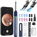Bebird Note 5 Ear Camera Wax Removal, Tool Tweezer.... Fixed Price $95.59.